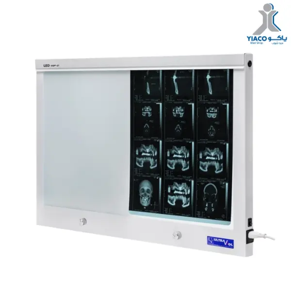 double led x-ray film viewer