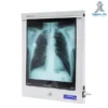 single led x-ray film viewer