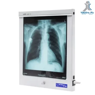 single led x-ray film viewer