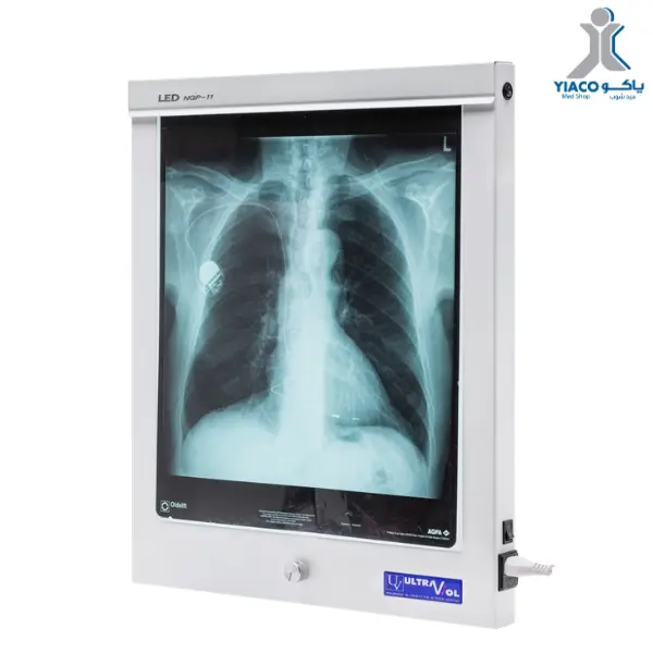 single led x-ray film viewer
